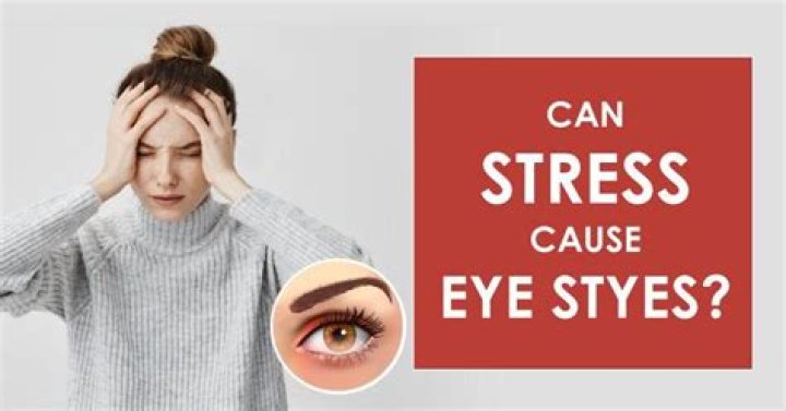 Are eye styes caused by stress?