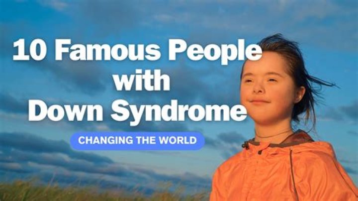 Are there famous people with Down syndrome?