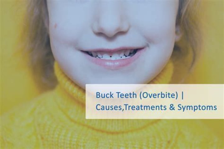 Can I file down my buck teeth?