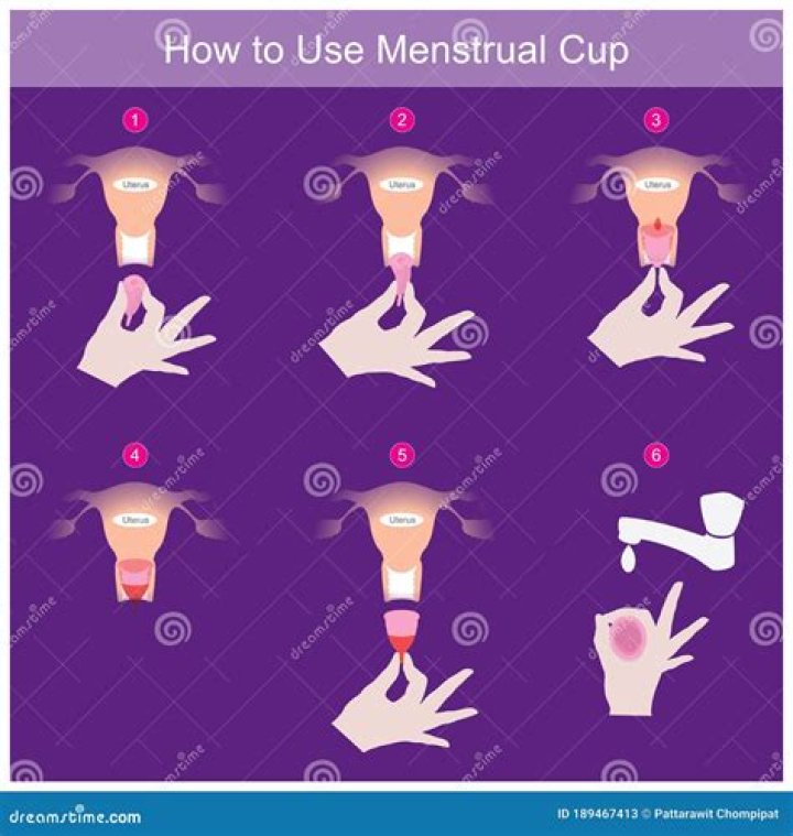 Can menstrual cup work on tilted cervix?
