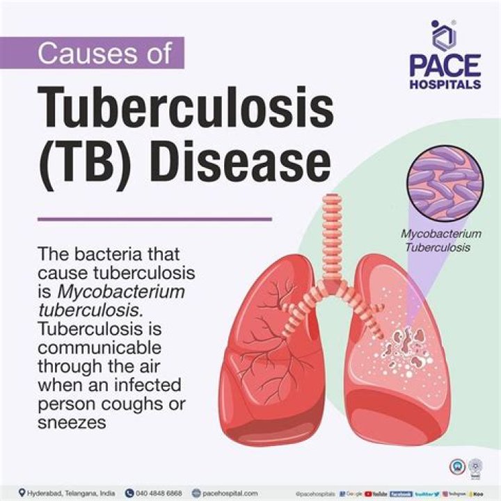 Can tuberculosis cause gout?