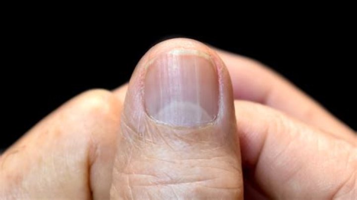 Can you speed up fingernail growth?