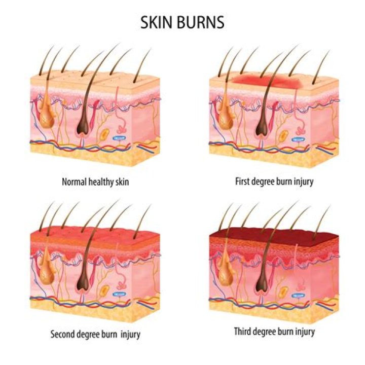 Do epidermis injuries scar?