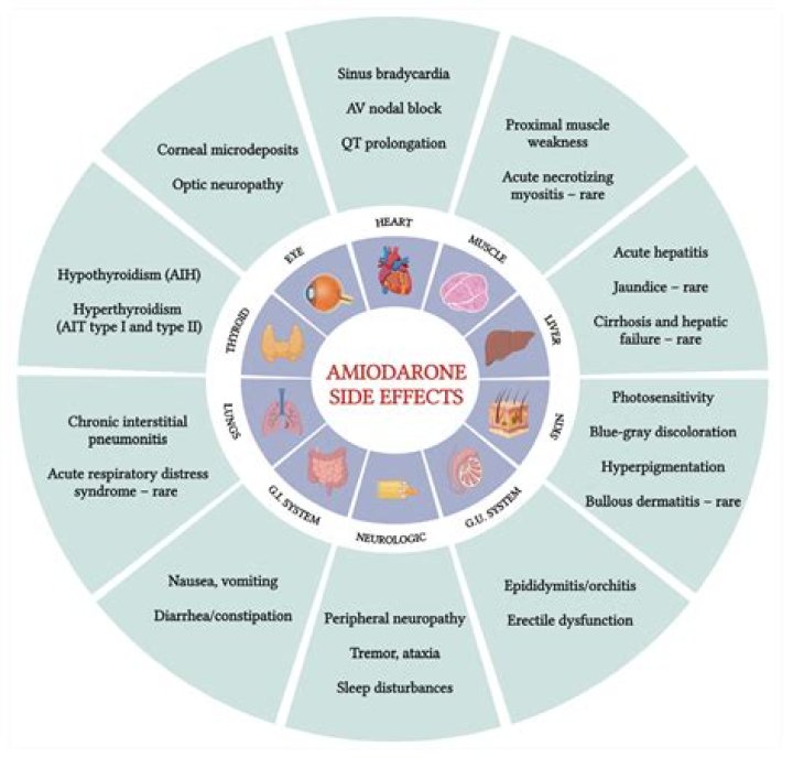 Does amiodarone cause photosensitivity