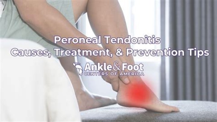 Does physical therapy work for peroneal tendonitis?