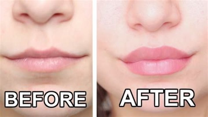 How can I make my lips bigger naturally?