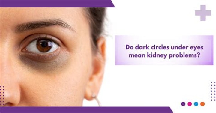 How can I reduce dark circles under my eyes?