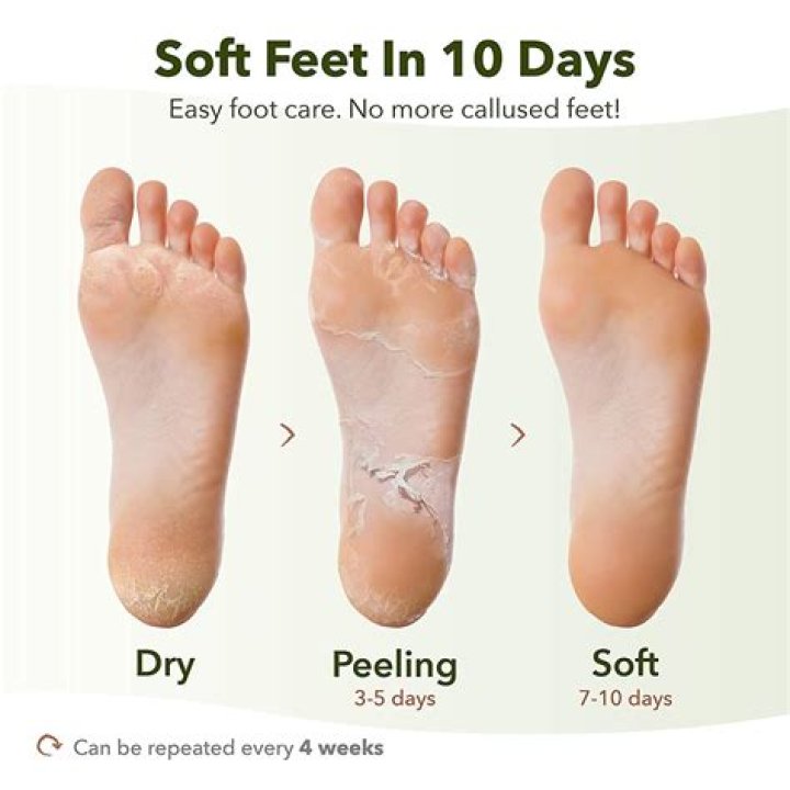 How can I take care of my feet in winter?