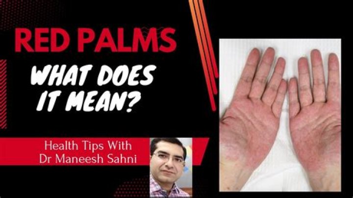 How do I dry my palms