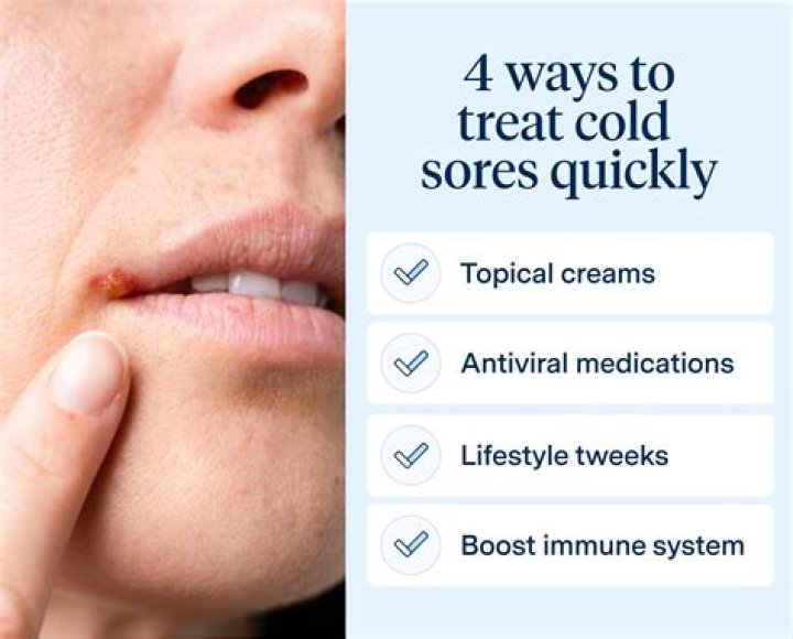 How do I get rid of a cold sore overnight?