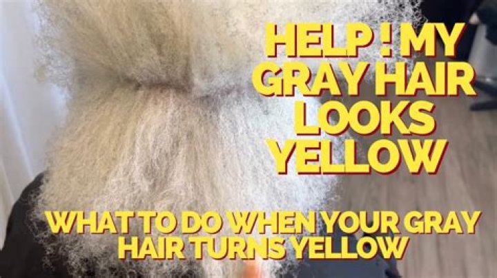 How do I get the yellow out of my white eyes?