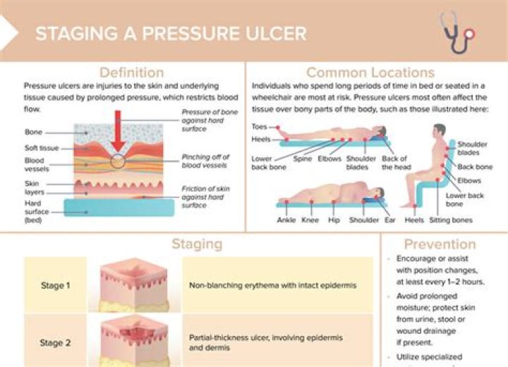 How do pressure ulcers form
