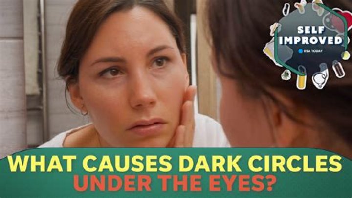 How do you fix dark circles?
