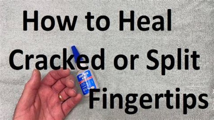 How do you heal cracked fingers overnight?