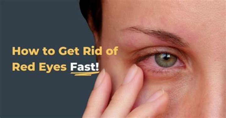 How do you make red eyes go away fast?