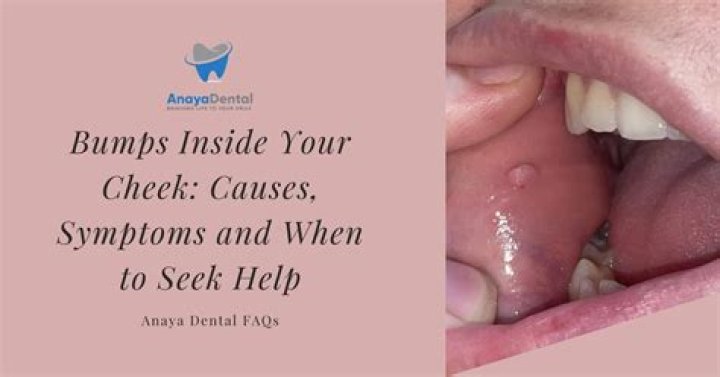 How do you make your bumps go down?