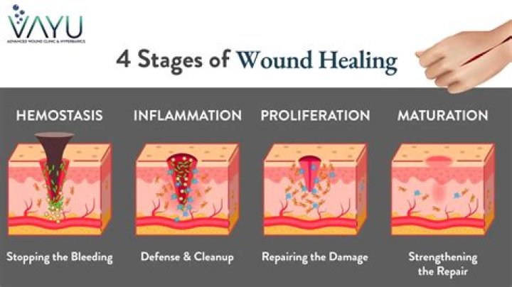 How does sugar affect wound healing?