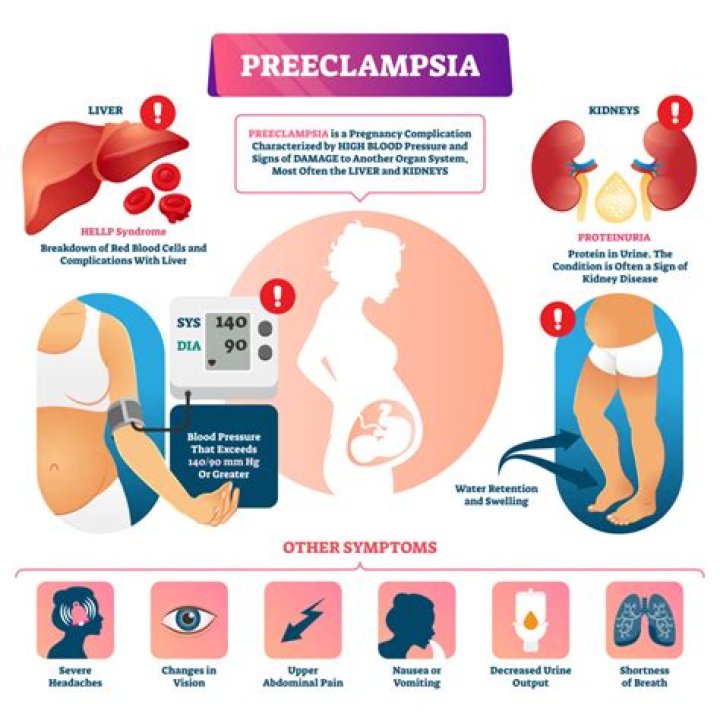 How fast can preeclampsia develop