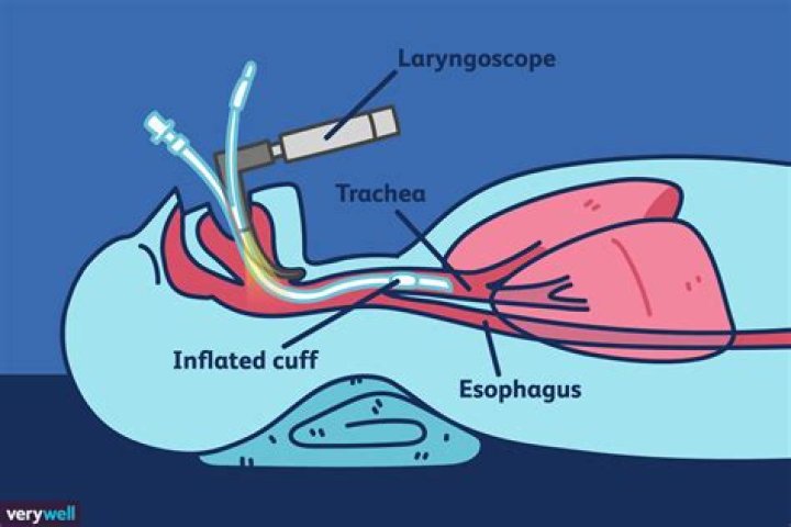 How long should it take to intubate a newborn