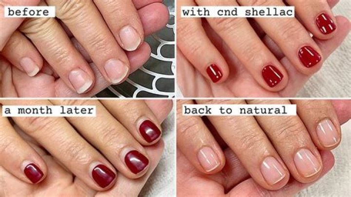 How old should you be to get Shellac nails?