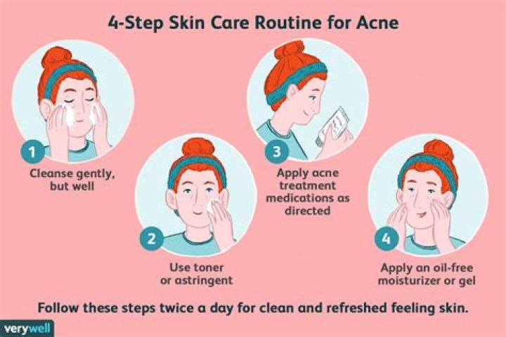 How to take care of your face for acne?