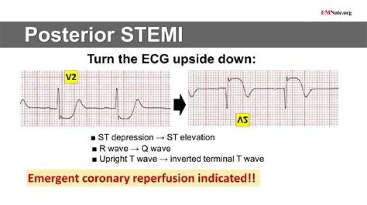 Is it uptick or up tick?