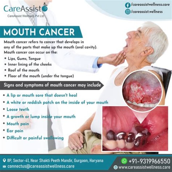 Is mouth cancer raised or flat?