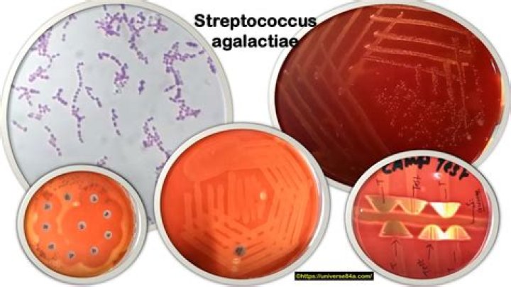 Is Streptococcus agalactiae CAMP positive or negative?