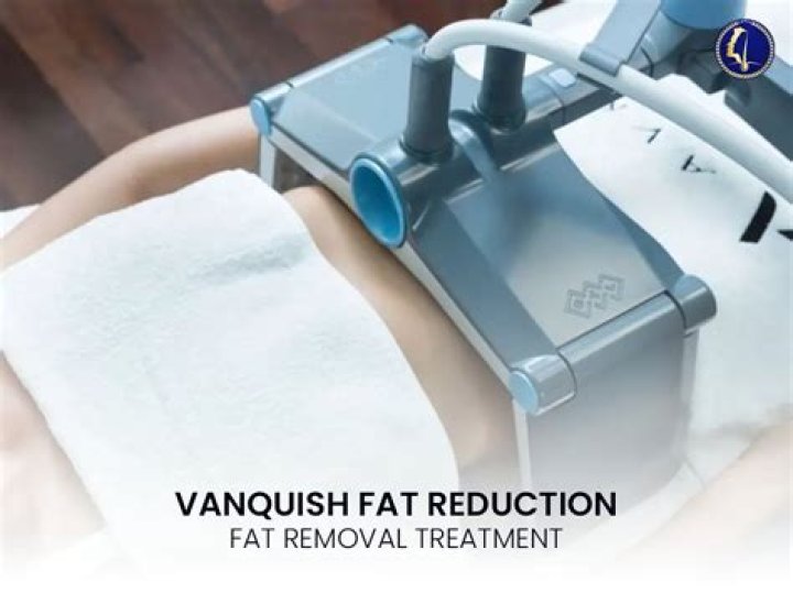 Is vanquish fat removal worth it?
