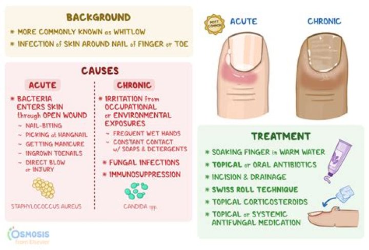 Should you use cuticle nippers?