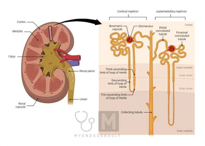 What are renal tumors?