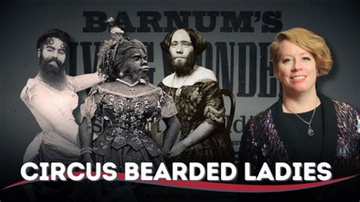 What causes bearded lady?