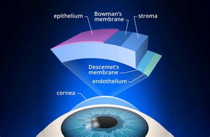 What causes thinning cornea