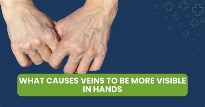 What causes veins to be more visible?