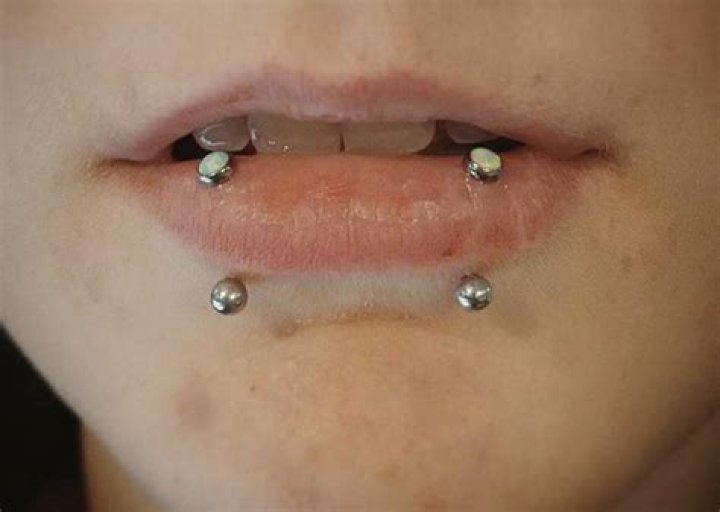 What do snakebites look like?