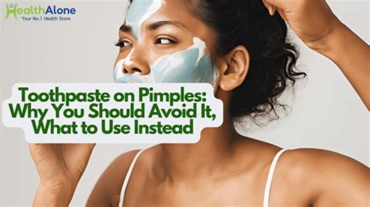 What do toothpaste do to pimples?