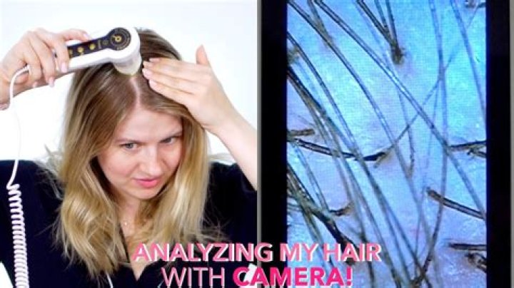 What do you look for when analyzing hair?
