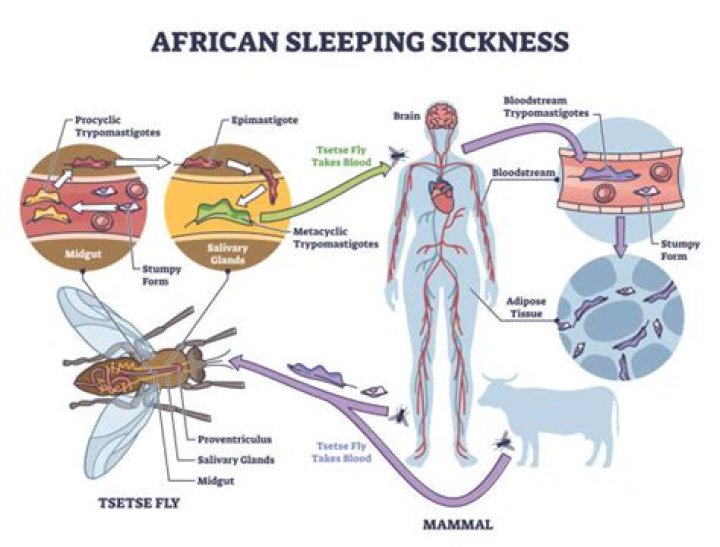What does African sleeping sickness do