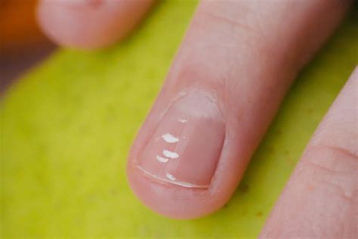 What happens if you have dirt in your nails?