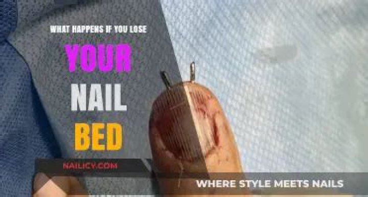What happens if you lose your nail bed?