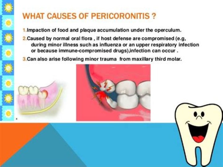 What is Periconitis?
