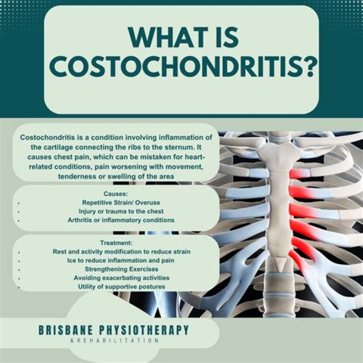 What is the best medicine for costochondritis?