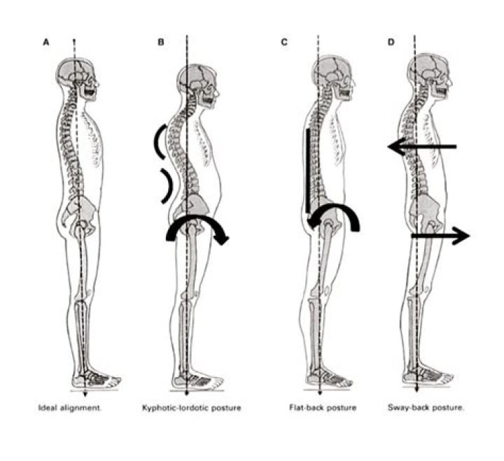 What is the ideal postural alignment?