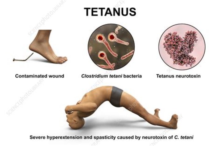 What is the mode of transmission for tetanus?