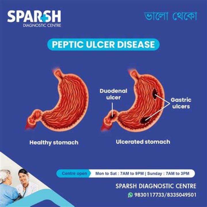 What is the most common treatment for peptic ulcer?