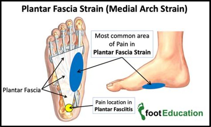 What is the plantar arch