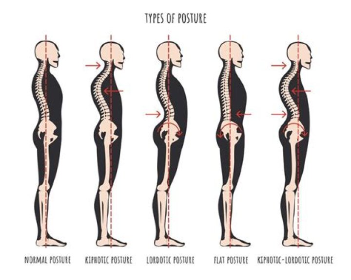 What is the posture of a toddler?