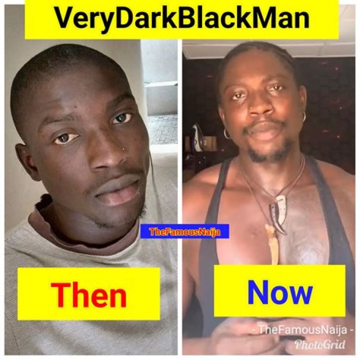 What is very dark skin called?