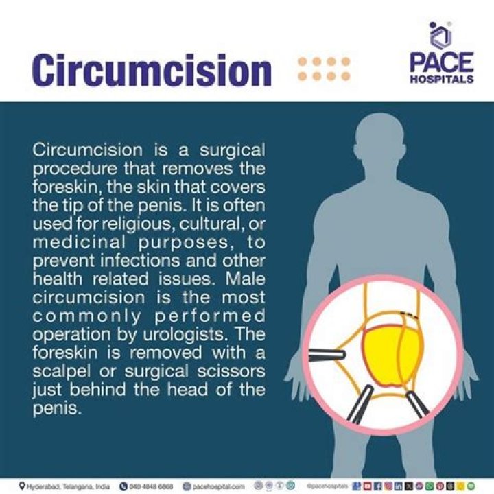 What percentage does circumcision prevent HIV?