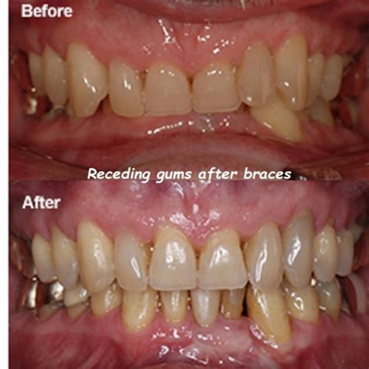 Why did the mass of gum decrease after chewing?
